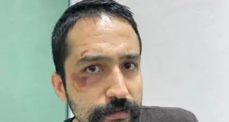 Turchia, arrestato e picchiato l’avvocato Aytaç Ünsal. Il ministero: «Tentava la fuga»