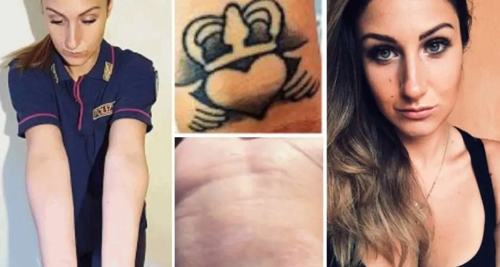 \"Io, cacciata dalla polizia per un tatuaggio cancellato farò ricorso alla Cedu\"