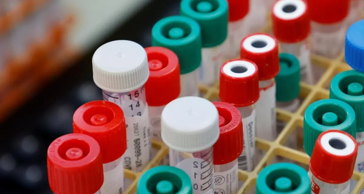 Covid, numeri in leggero calo: 20.648 i nuovi casi e 541 vittime